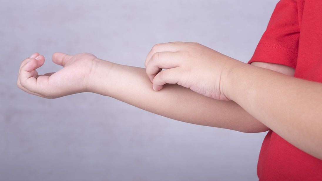 dry-itchy-skin-childs-farm